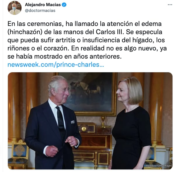 Manos del Rey Carlos III