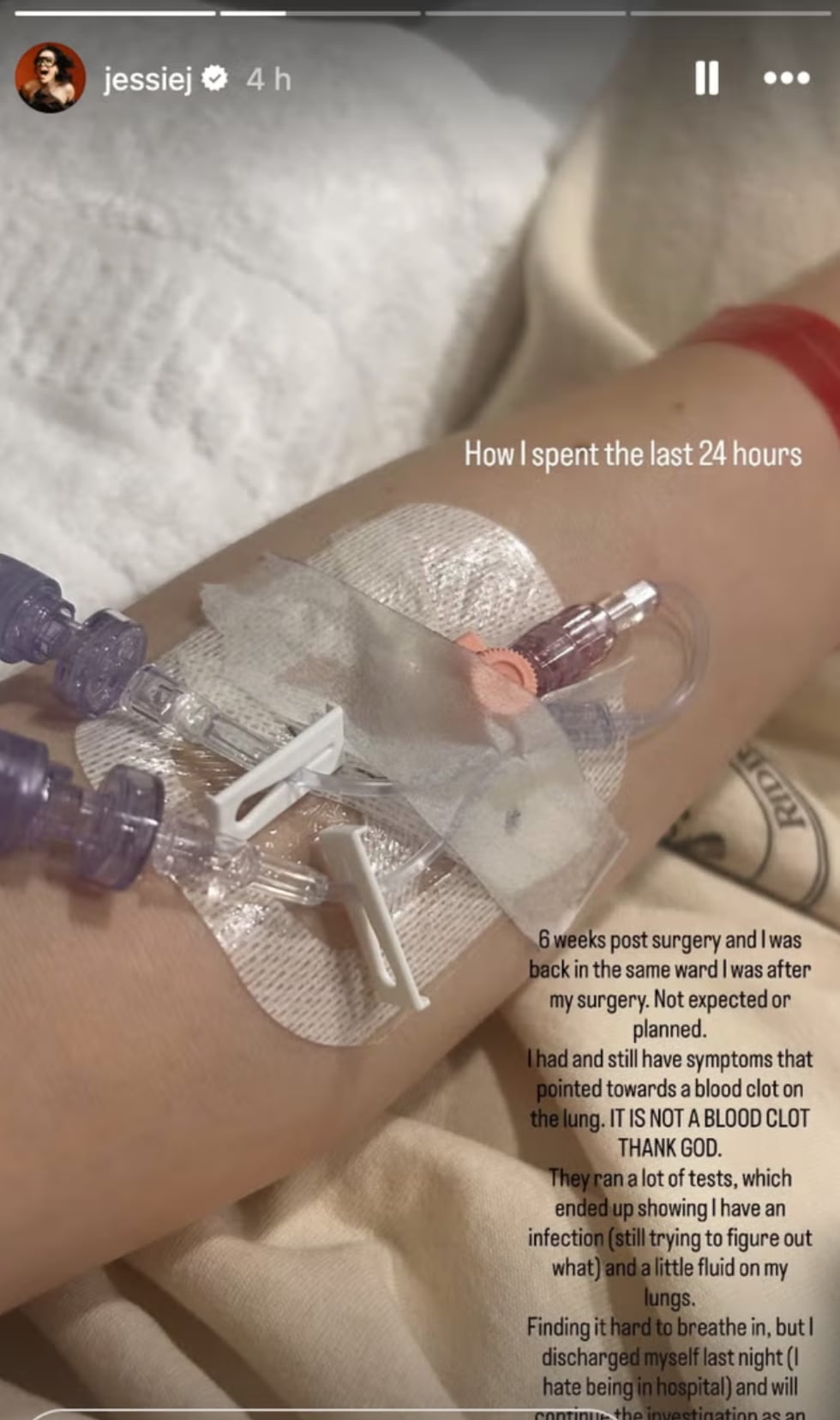 Jessie J es hospitalizada de emergencia por no poder respirar
