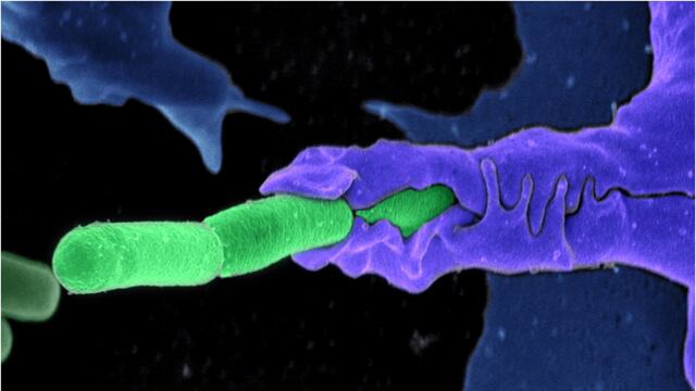 La OMS alertó de un brote de ántrax en Zambia