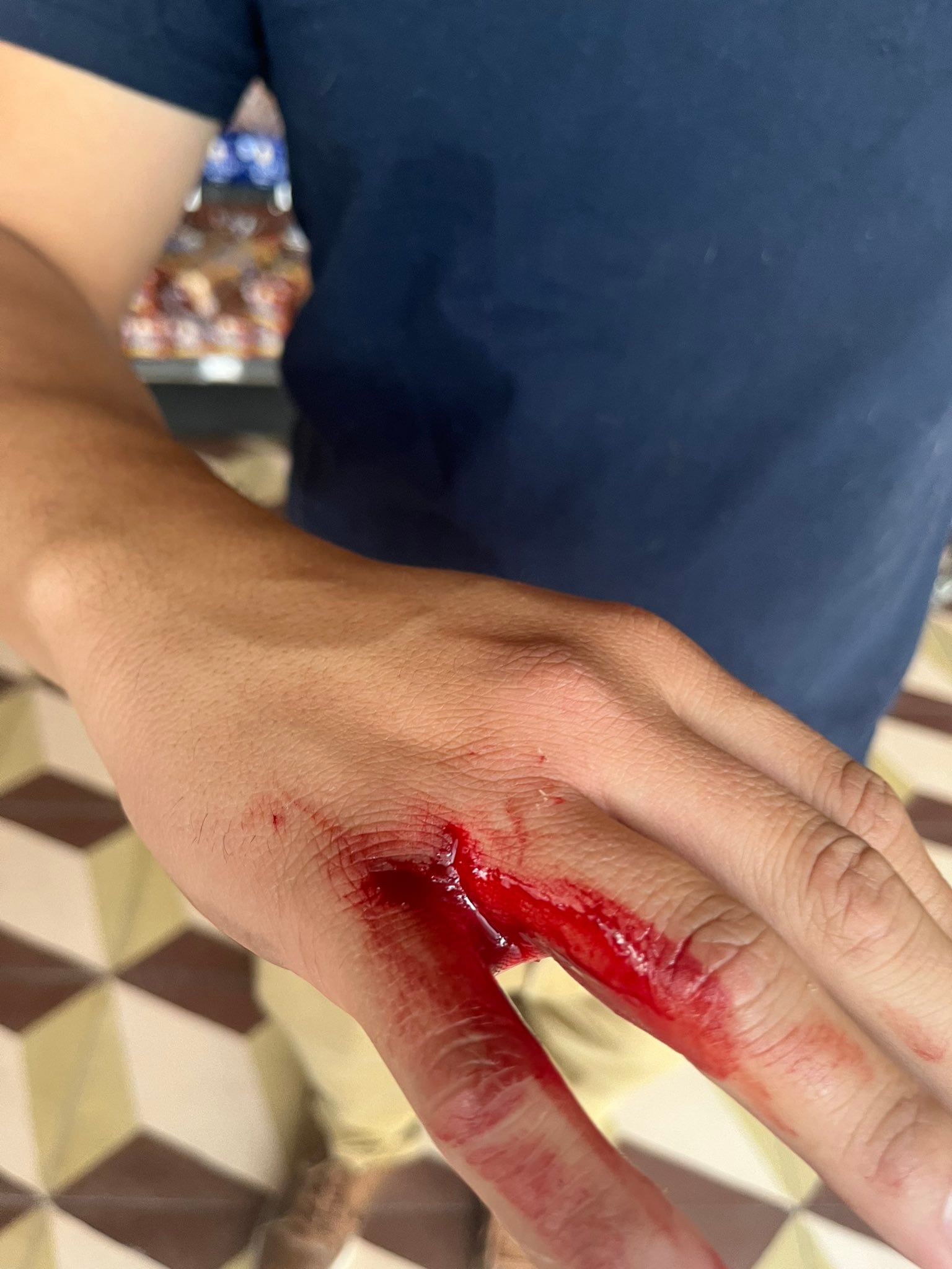 Lesiones por agresión de hombre a pareja en San Luis Potosí