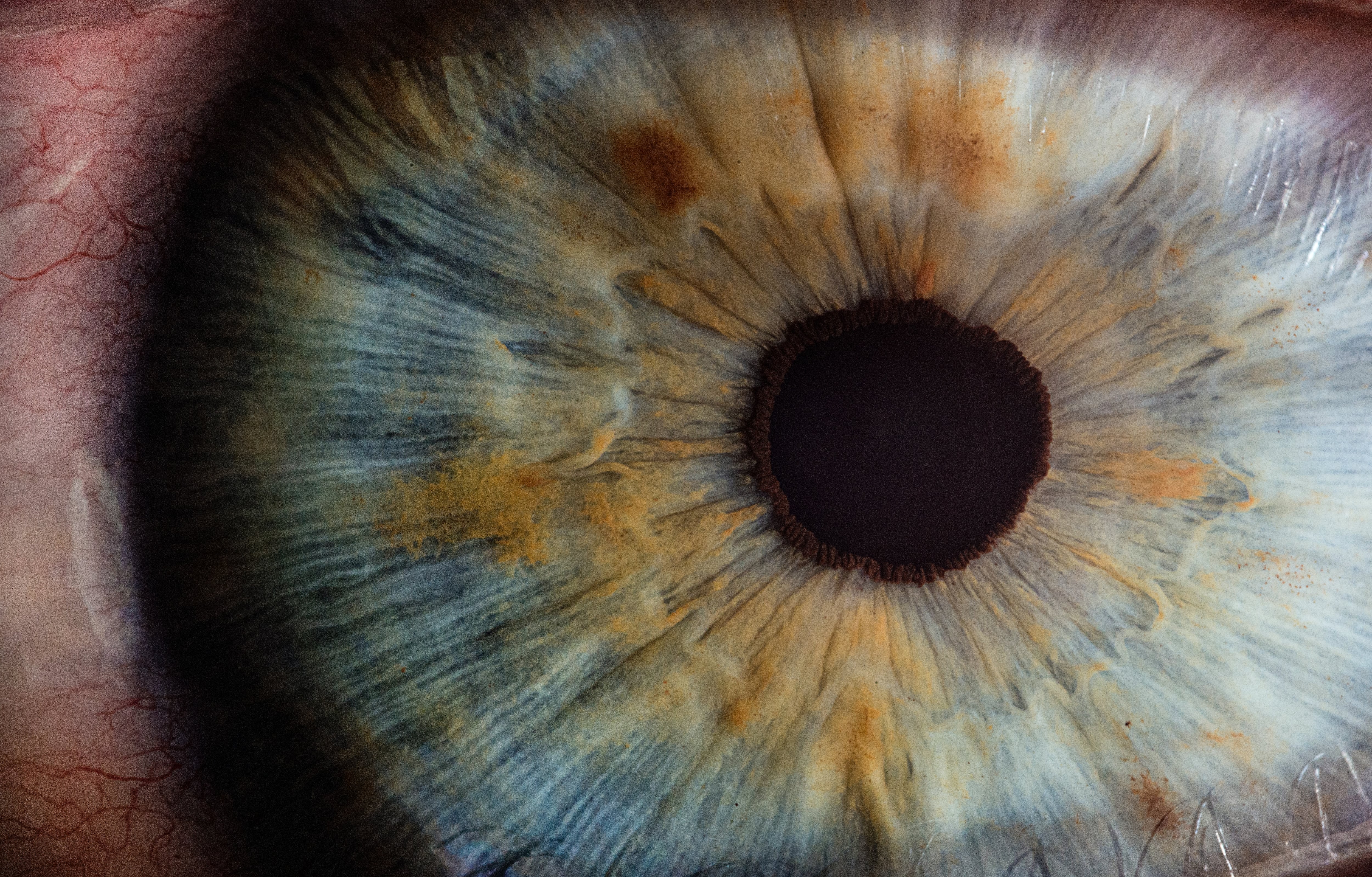 Ojo