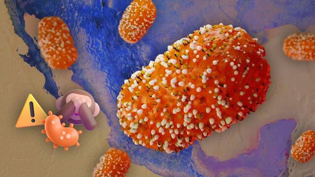 Viruela del mono en México