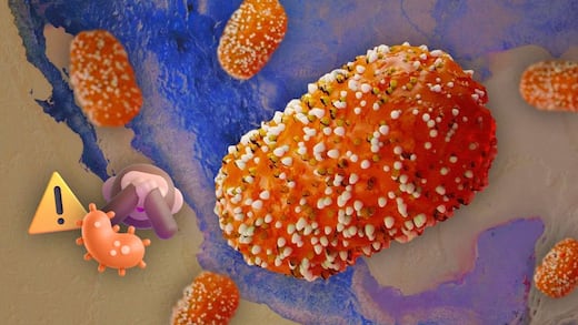 Viruela del mono mpox en México: Estos son los estados con más casos