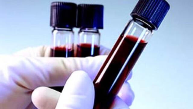 ¿Qué es el grupo sanguíneo MAL?