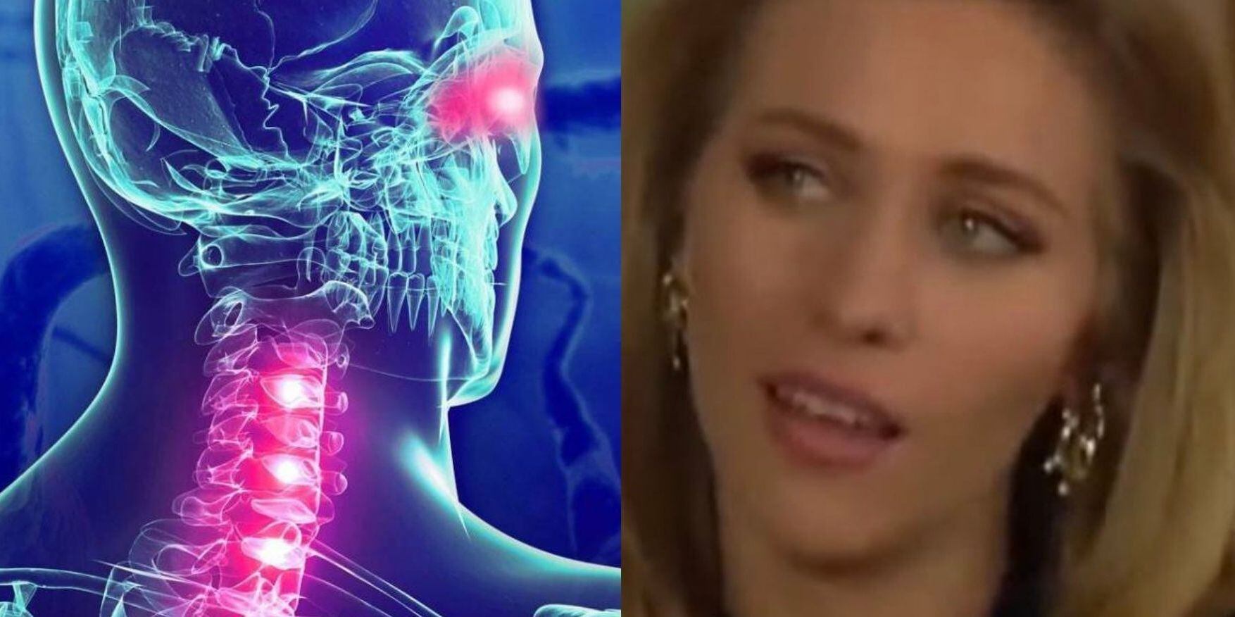 ¿Qué es la esclerosis múltiple, enfermedad que padece Mónica Dossetti, actriz violentada por su hermano?