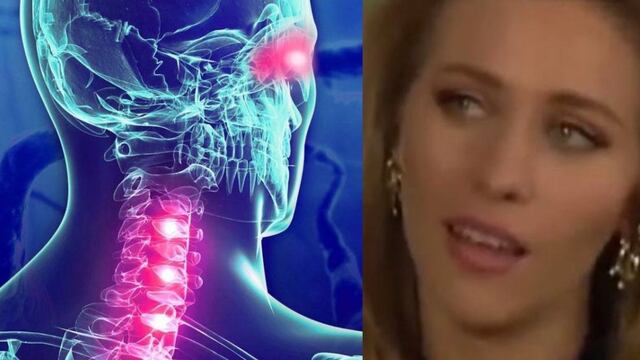 ¿Qué es la esclerosis múltiple, enfermedad que padece Mónica Dossetti, actriz violentada por su hermano?