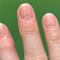 Uñas Covid-19: Virus dejaría marcas o las cambiaría de color