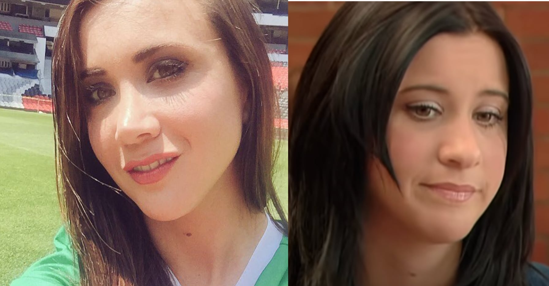 El rostro de Mariazel cambió por el disparo en su rostro