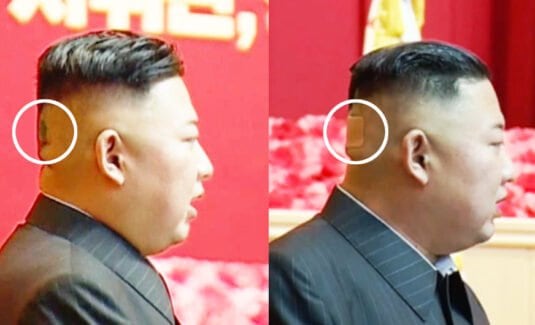 Kim Jong-un