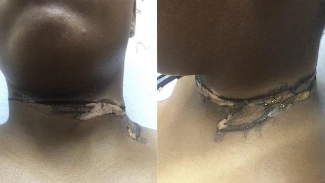 Cargador de su teléfono le quema el cuello.