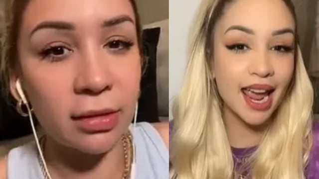 Antes y después de la cirugía de Daniela Rodrice.