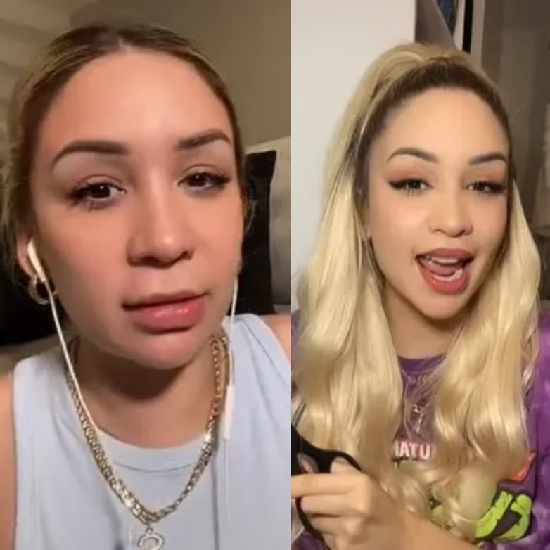 Antes y después de la cirugía de Daniela Rodrice.