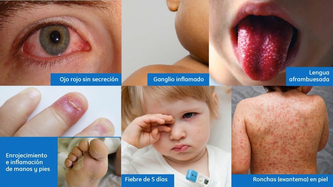 Imagen 1