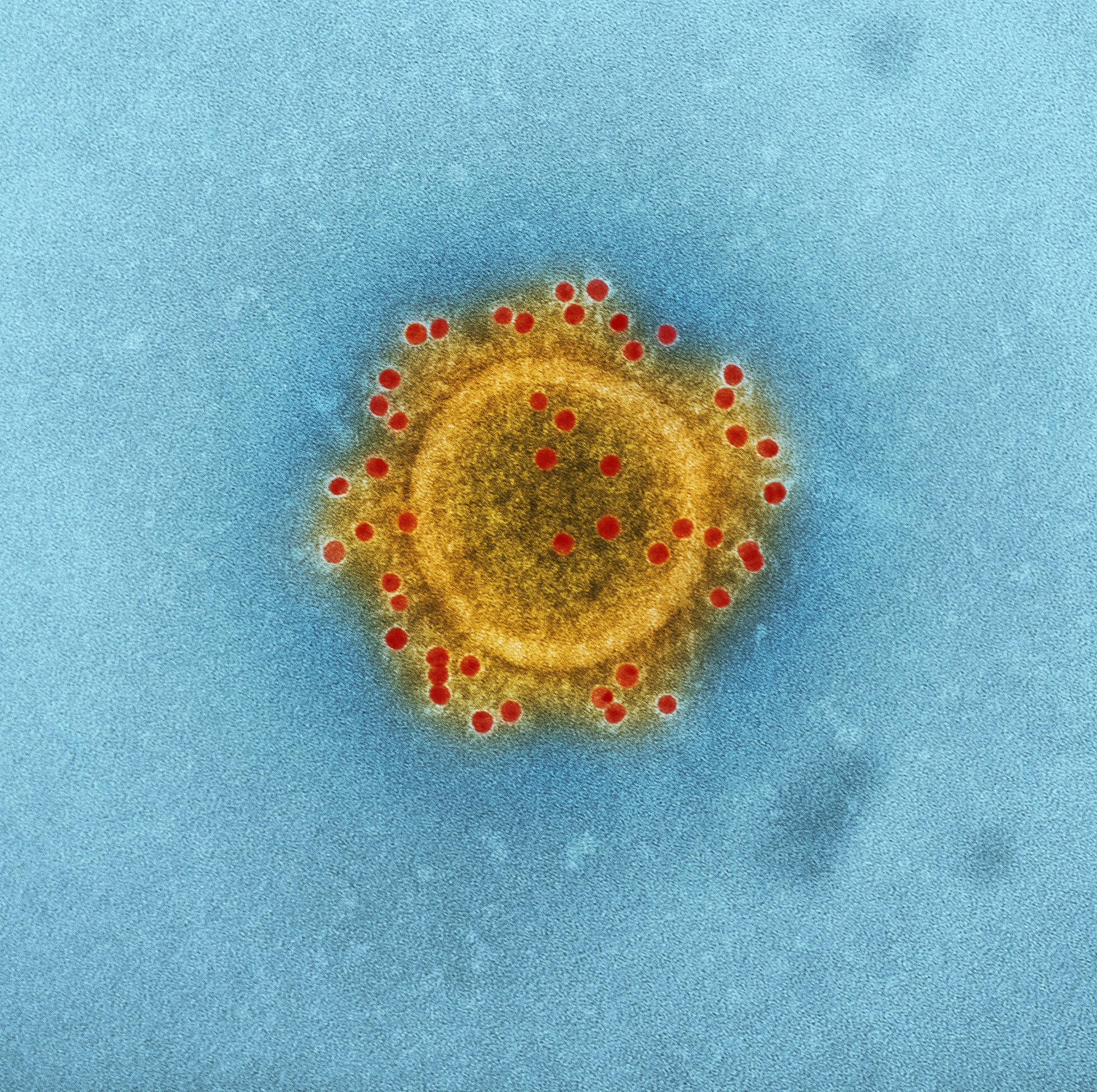 Bacteria