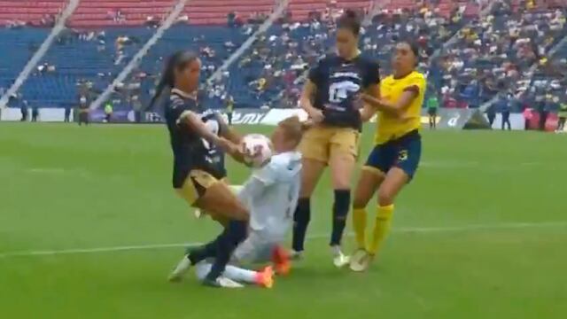 Mano de la jugadora de Pumas en el Clásico Capitalino