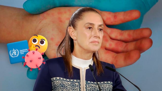 Claudia Sheinbaum responde sobre la certificación de la OMS ante casos de sarampión