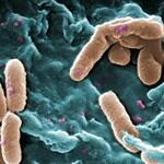 Bacteria Pseudomonas aeruginosa