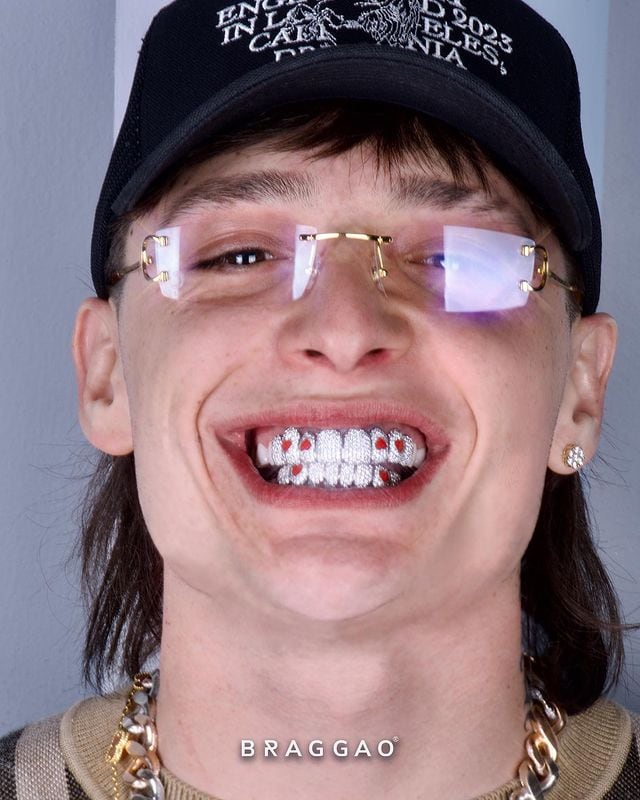 Peso Pluma y su grillz de diamantes