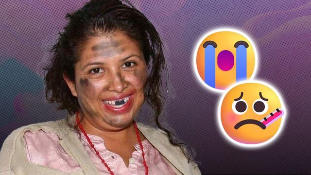 Liliana Arriaga, mejor conocida como La Chupitos, reveló algunos detalles del síndrome de Sjögren que padece