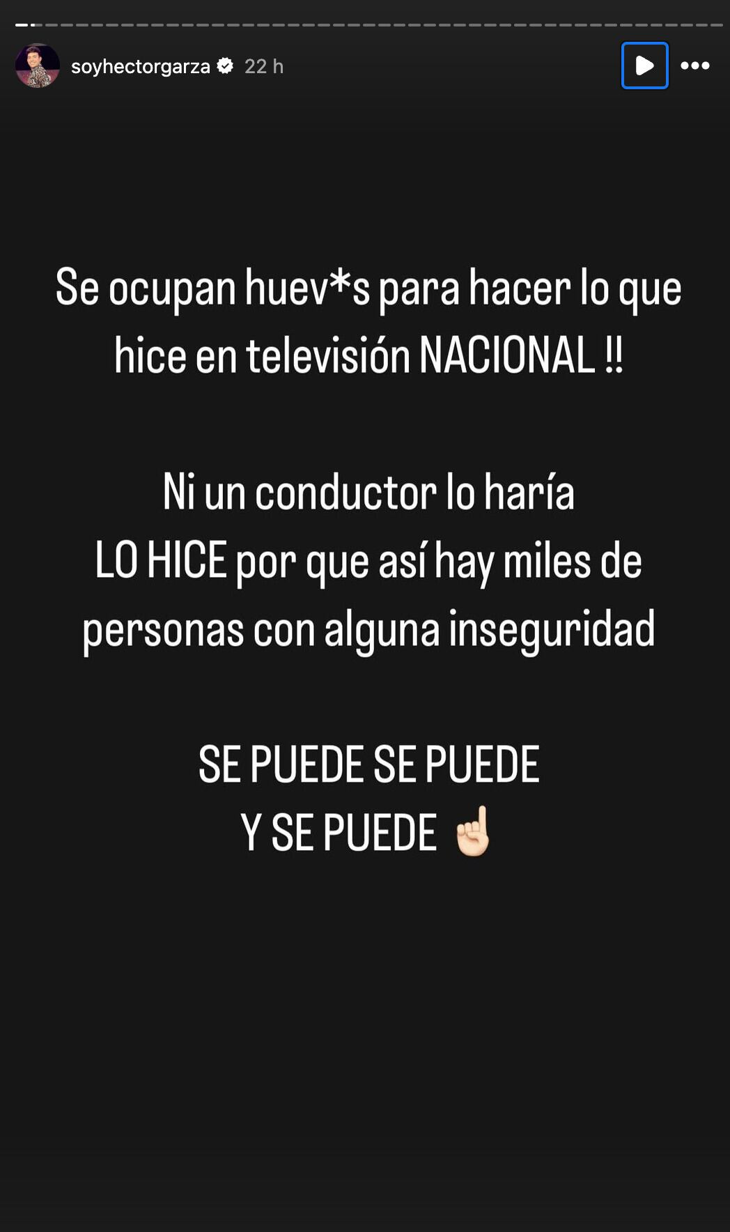 Héctor Garza habla tras quitarse el peluquín en Es Show