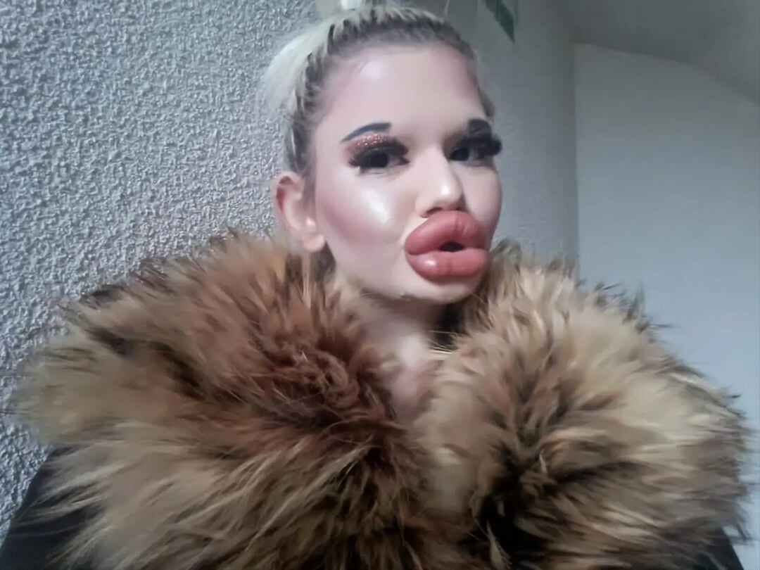 Andrea Ivanova, la mujer con los labios más grandes