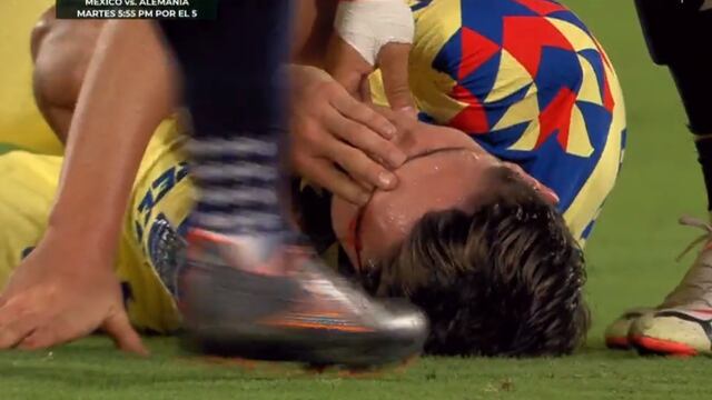 Israel Reyes fue herido por un codazo de Ricardo Marín, que no ameritó expulsión según el árbitro.