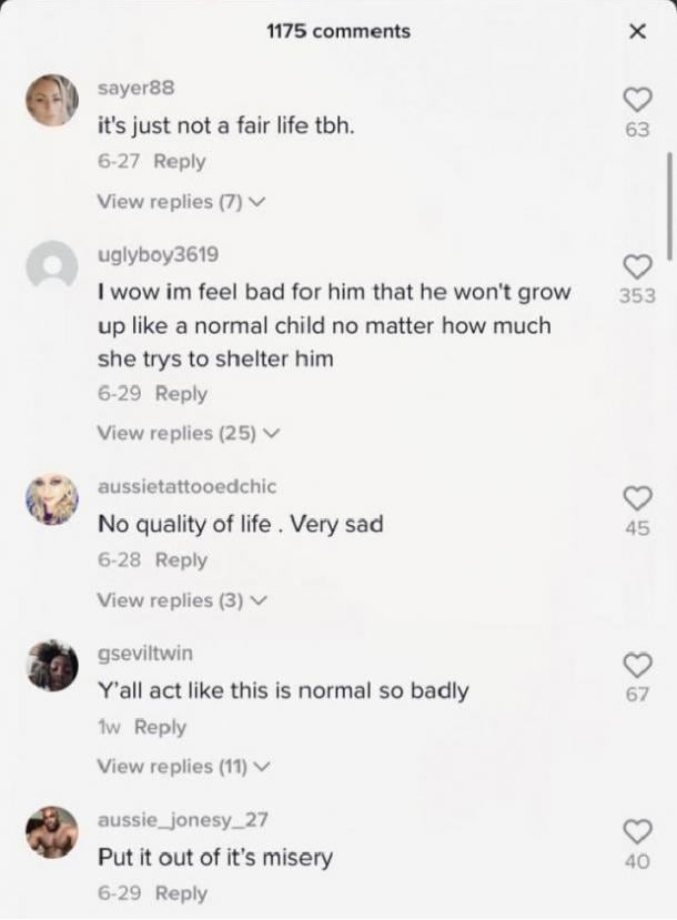 Comentarios sobre Ember Torres