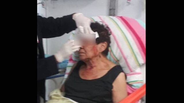 La exdiputada María Viola Corella, fue golpeada.