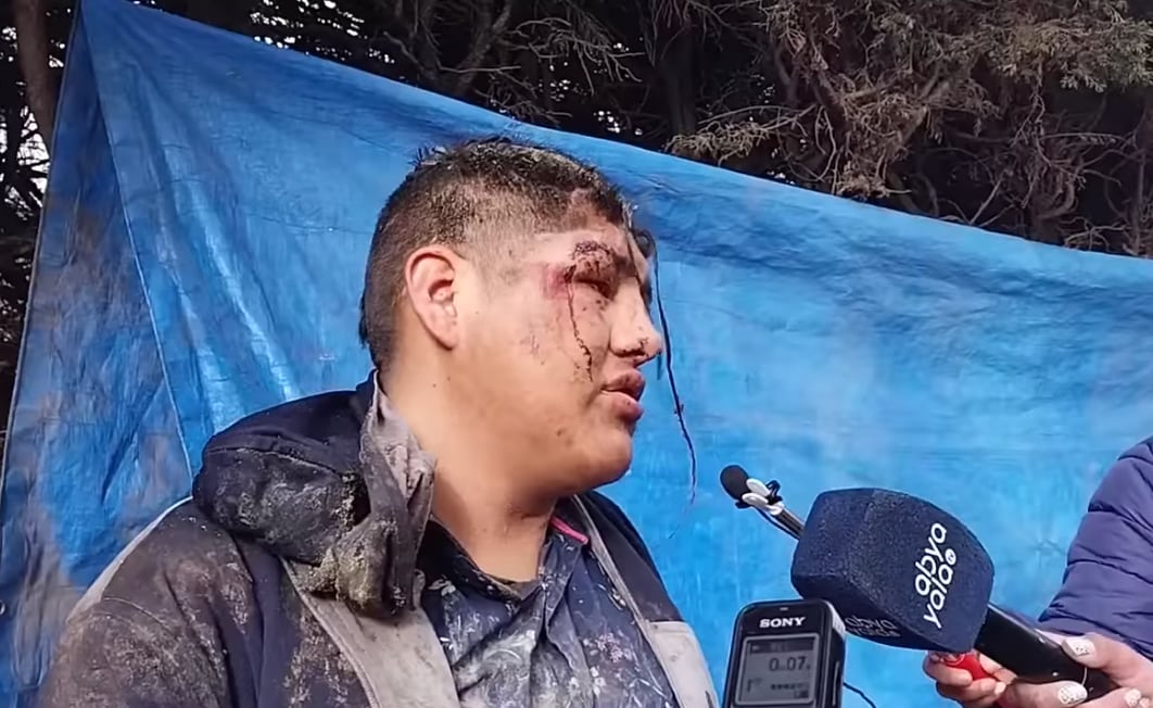 Víctor Hugo, quien despertó en el ataúd