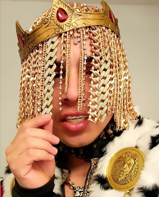Dan Sur, se implantó "cadenas de oro" como cabello