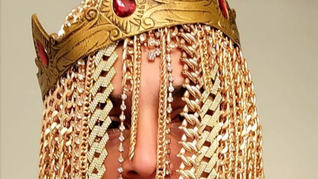 Dan Sur, se implantó "cadenas de oro" como cabello