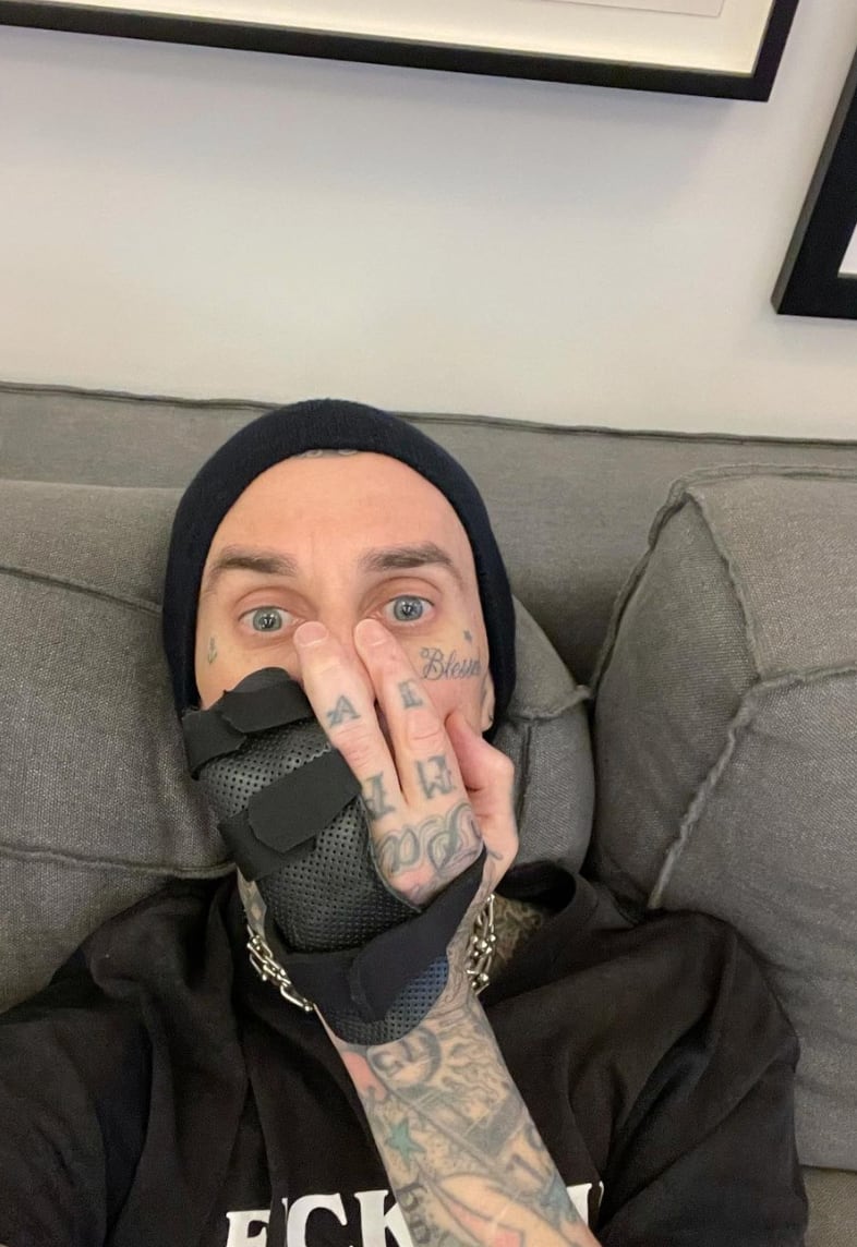 Lesión Travis Barker