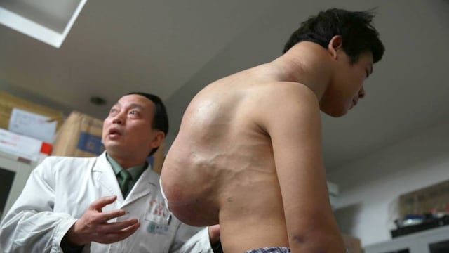 Xiao Yang "El hombre camello"