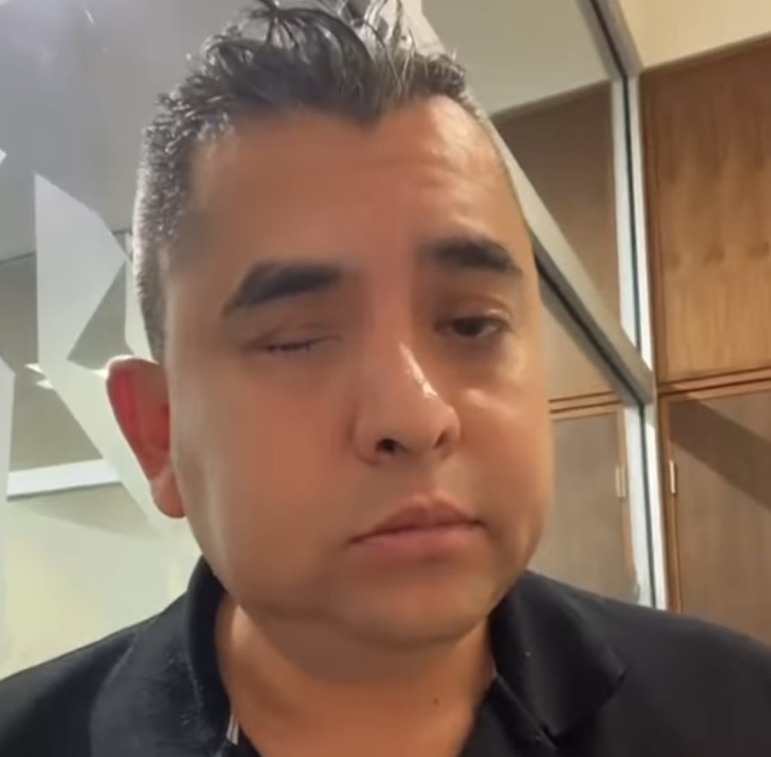 Sebastián Castillo, escolta presuntamente agredido por Fofo Márquez
