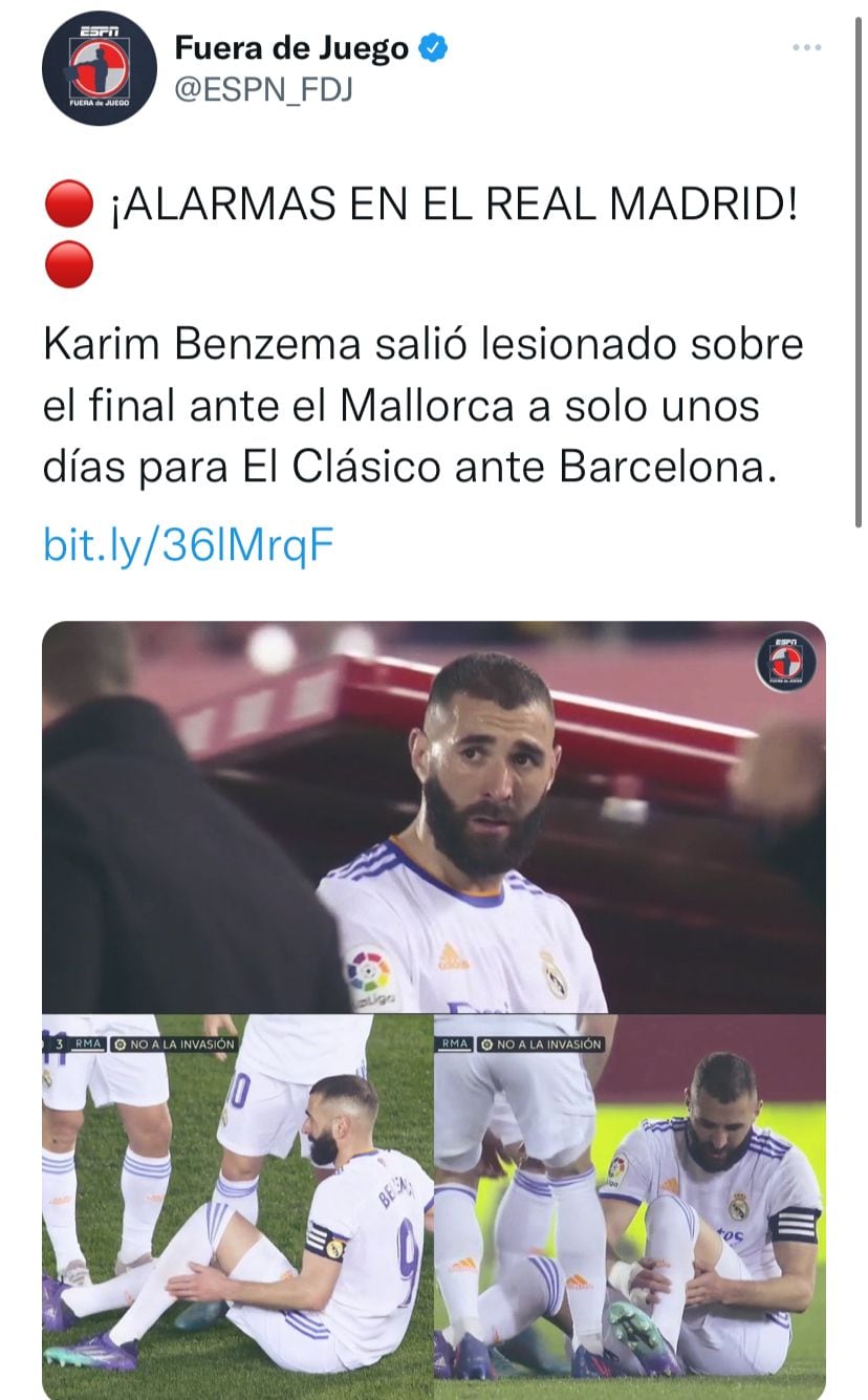 Karim Benzema salió con molestias del partido entre el Real Madrid y el RCD Mallorca.