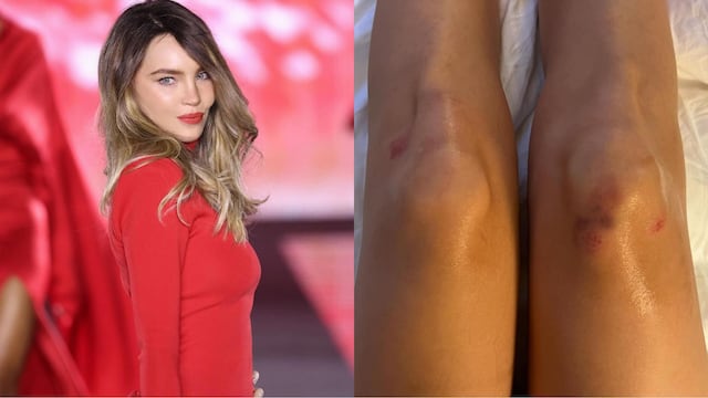 Belinda se lastimó las rodillas en el Paris Fashion Week