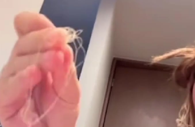 Tammy Parra se quedó pelona por decolorarse el cabello sola