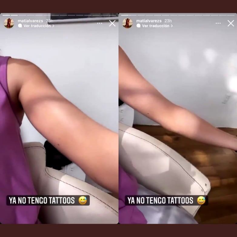 Mati Álvarez cubre los tatuajes de su brazo.
