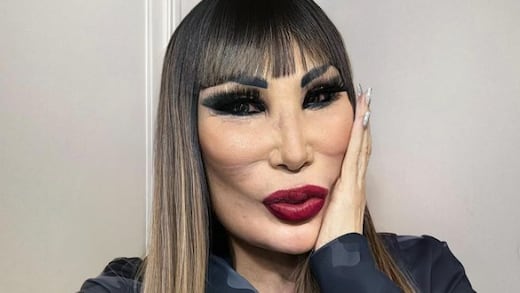 La foto de Lyn May que terminó de callar a los haters que se atreven a burlarse de su rostro