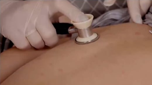 CDMX precisa edad del menor fallecido por sarampión