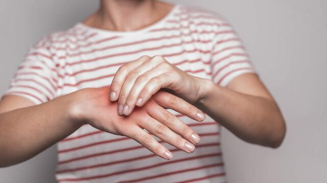 ¿Síndrome de Sudeck se cura? 11 síntomas, cómo se diagnostica y qué es