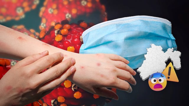 Brotes de sarampión obligan cubrebocas y filtros en escuelas.