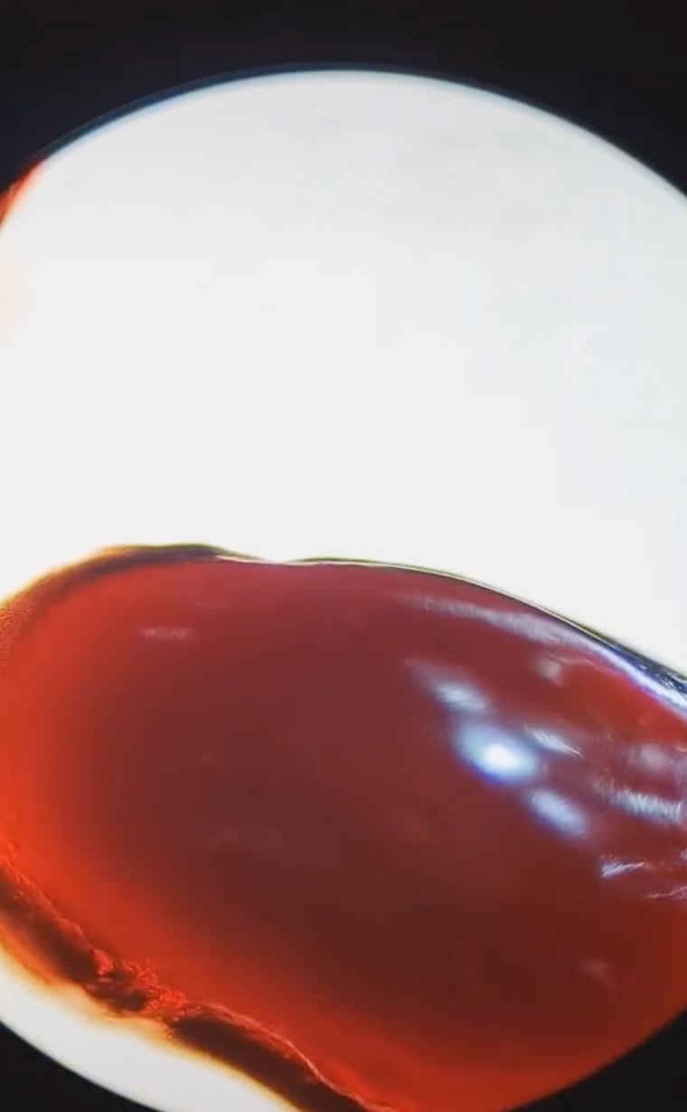 Coágulo de sangre menstrual bajo el microscopio