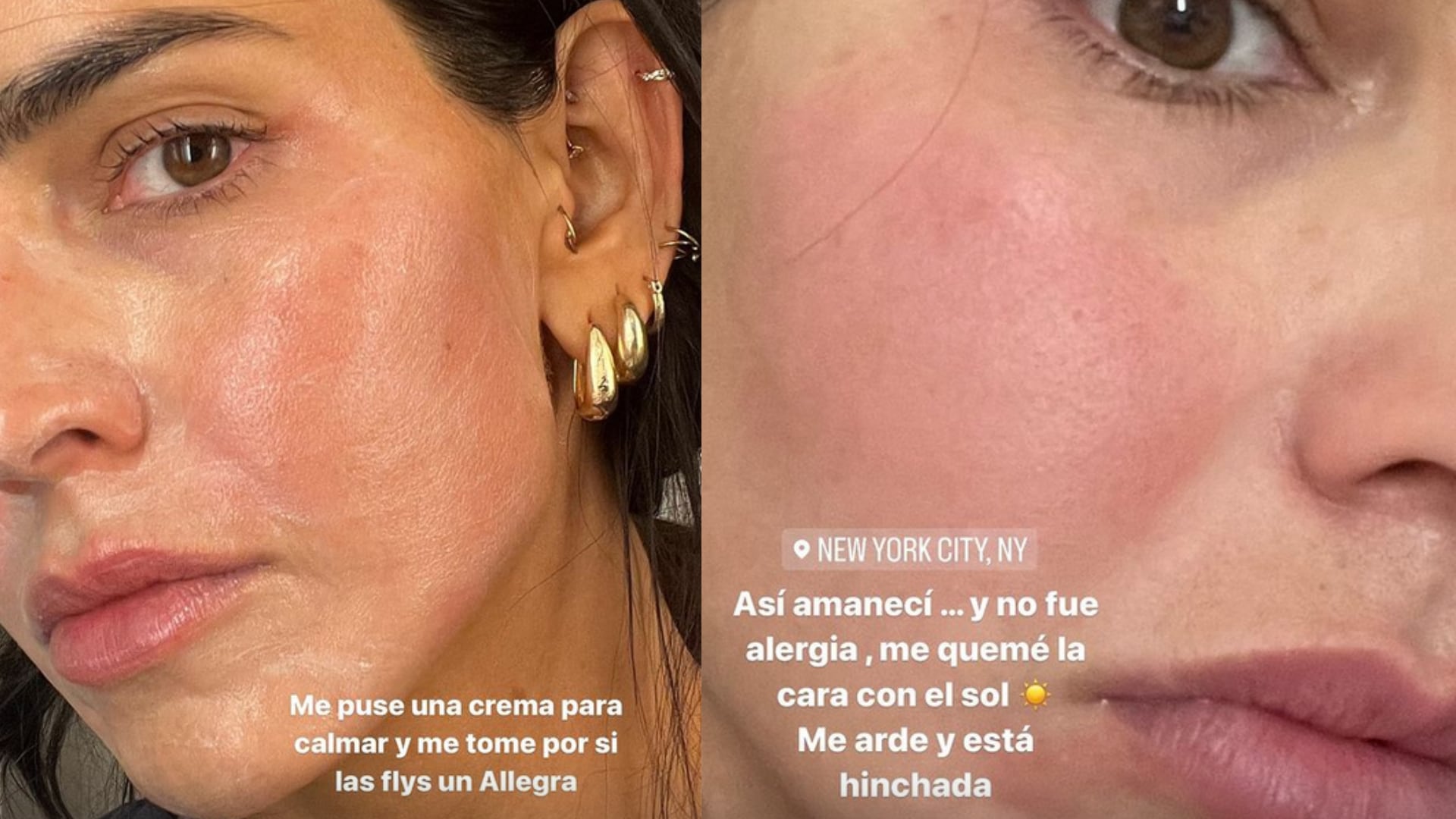 Bárbara de Regil comparte que se quemó la cara, pero en Nueva York.