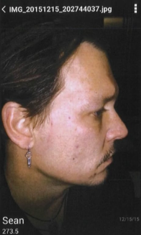 Evidencia de que Amber Heard golpeaba a Jhonny Deep