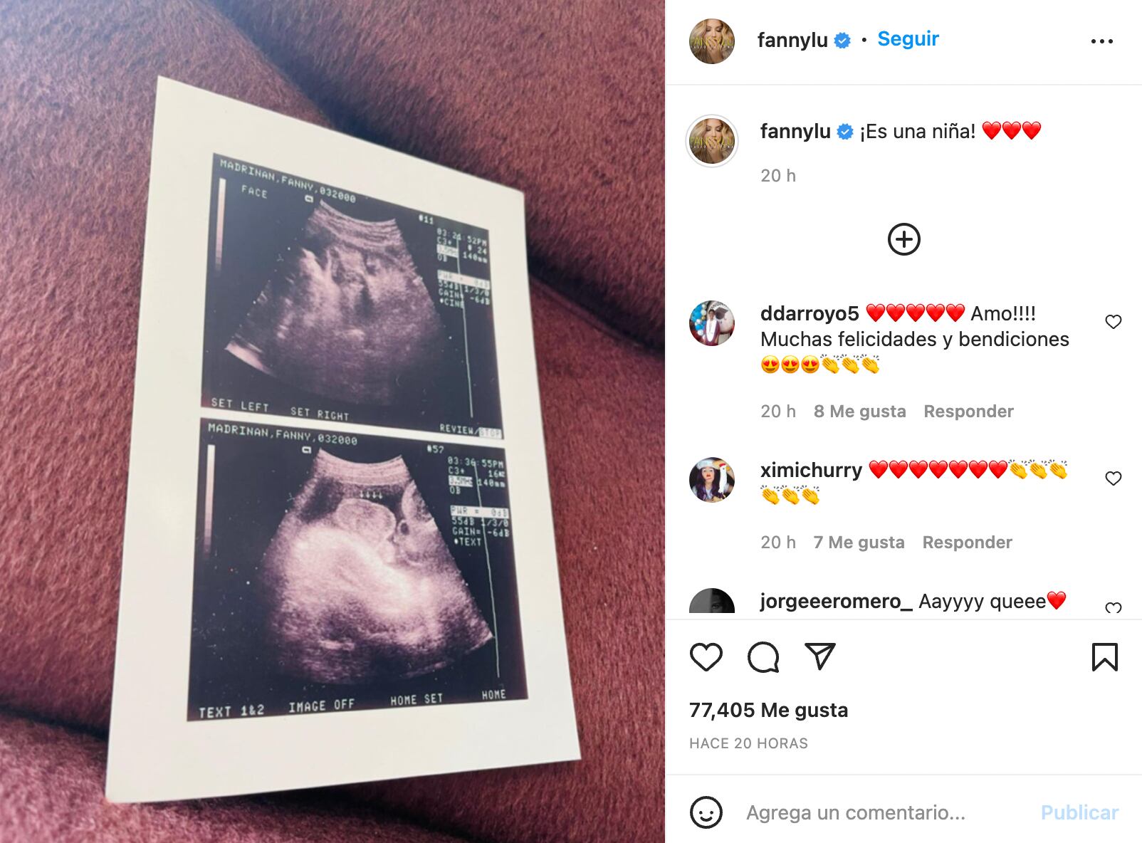 Fanny Lu comparte ultrasonido