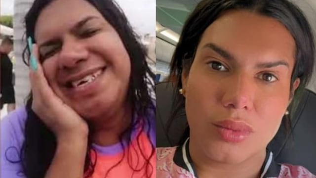 Kimberly Irene, la más preciosa, antes y después