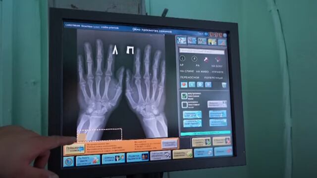 Médico se implanta microchips