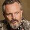 A Miguel Bosé le cambió la voz pero no quiere revelar por qué