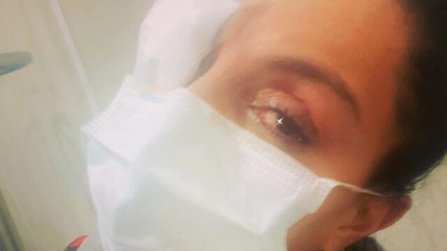 Ivonne Montero sufre accidente